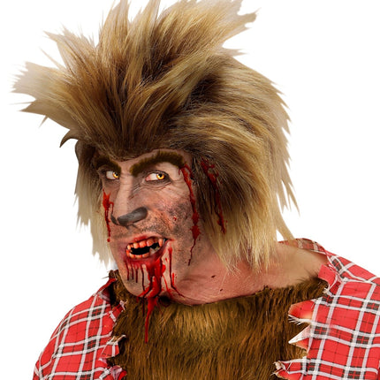 Tube Bloed Met Gebit