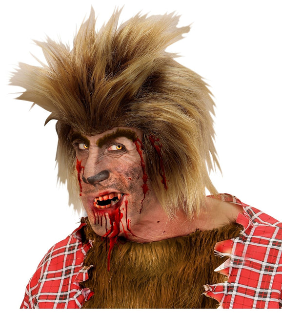 Tube Bloed Met Gebit